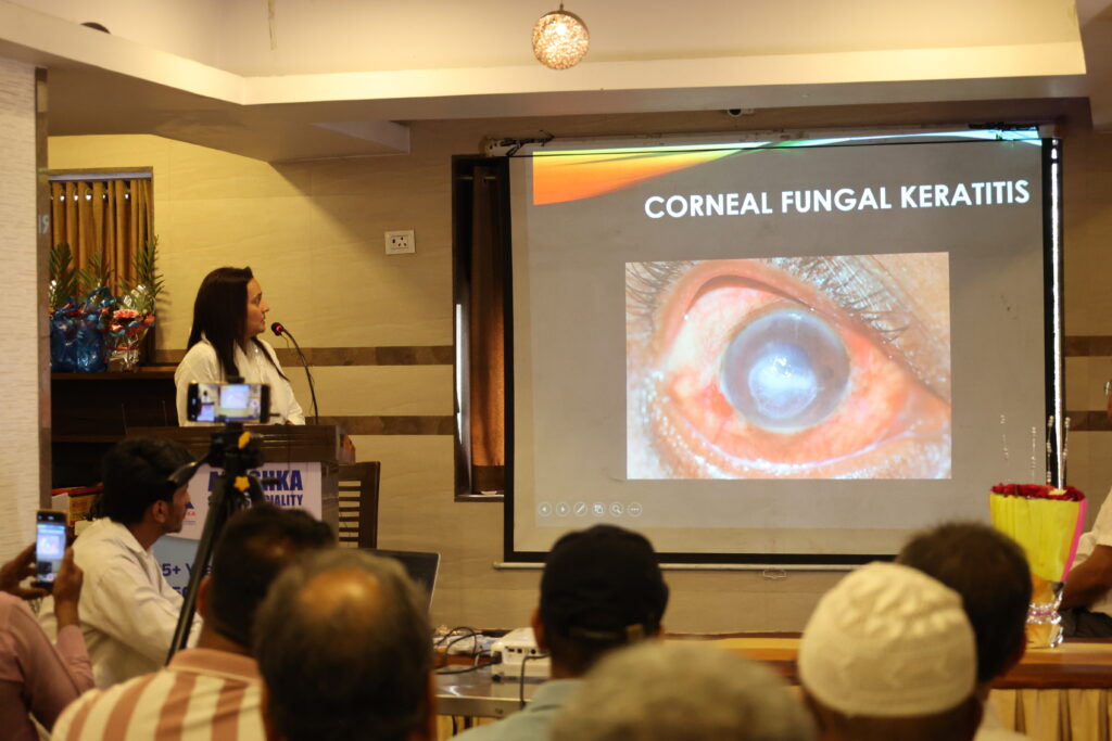 cornea services