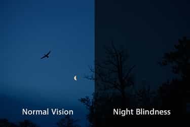 Night blindness